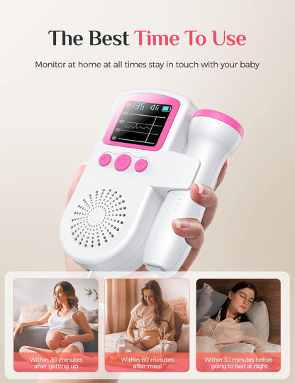 💖 60% OFF Smart Fetal Doppler – Bond Anytime at Home!